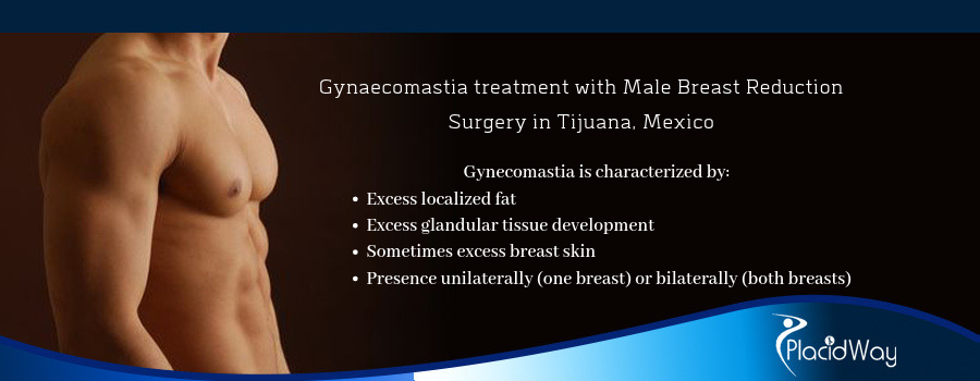 Gynaecomastia in Tijuana, Mexico